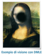 img monalisa Degenerazione Maculare Legata allEtà (DMLE)